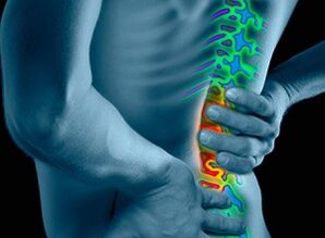 causas e síntomas da osteocondrose