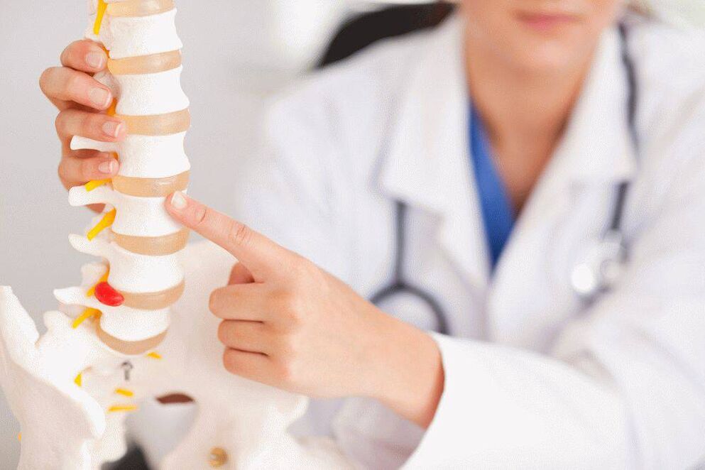 O médico sobre a osteocondrose e a súa prevención