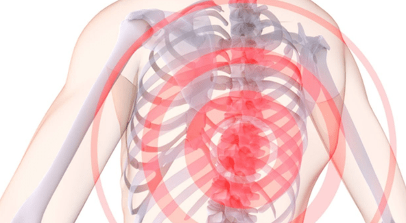 dor na columna vertebral con osteocondrose torácica